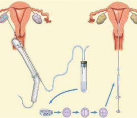 35岁女性备孕请做好以下检查，“健康绍兴代生宝宝”跑不远